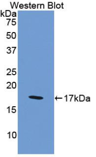F8 / FVIII / Factor VIII Antibody - Western blot of recombinant F8 / FVIII / Factor VIII.  This image was taken for the unconjugated form of this product. Other forms have not been tested.