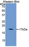 F8 / FVIII / Factor VIII Antibody - Western blot of recombinant F8 / FVIII / Factor VIII.  This image was taken for the unconjugated form of this product. Other forms have not been tested.