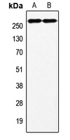 F8 / FVIII / Factor VIII Antibody - Western blot analysis of Factor VIII expression in HeLa (A); HepG2 (B) whole cell lysates.