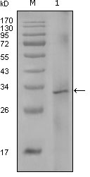 F8 / FVIII / Factor VIII Antibody - Western blot using F8 mouse monoclonal antibody against truncated Trx-F8 recombinant protein (1).