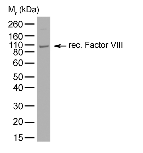 F8 / FVIII / Factor VIII Antibody - Recombinant Factor VIII probed with Mouse anti-Human Factor VIII