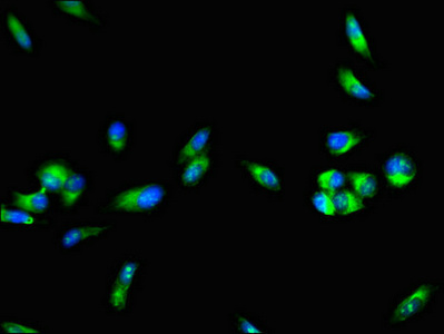F8 / FVIII / Factor VIII Antibody - Immunofluorescent analysis of Hela cells using F8 Antibody at dilution of 1:100 and Alexa Fluor 488-congugated AffiniPure Goat Anti-Rabbit IgG(H+L)