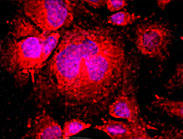 F8 / FVIII / Factor VIII Antibody - Factor VIII staining in C57 cells. Formalin-fixed mouse C57 cells are stained with Factor VIII Antibody used at 1:200 dilution and a PE-conjugated secondary antibody.