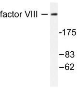 F8 / FVIII / Factor VIII Antibody - Western blot of. Factor VIII (S2194) pAb in extracts from HUVEC cells.