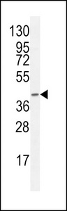 F8A1 / HAP40 Antibody - F8A2 Antibody western blot of CEM cell line lysates (35 ug/lane). The F8A2 antibody detected the F8A2 protein (arrow).