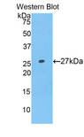 F9 / Factor IX Antibody - Western blot of recombinant F9 / Factor IX.  This image was taken for the unconjugated form of this product. Other forms have not been tested.