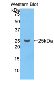 F9 / Factor IX Antibody - Western blot of recombinant F9 / Factor IX.  This image was taken for the unconjugated form of this product. Other forms have not been tested.
