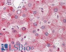 F9 / Factor IX Antibody - Anti-F9 / Factor IX antibody IHC of human liver. Immunohistochemistry of formalin-fixed, paraffin-embedded tissue after heat-induced antigen retrieval. Antibody concentration 10 ug/ml.