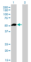 F9 / Factor IX Antibody - Western Blot analysis of F9 expression in transfected 293T cell line by F9 monoclonal antibody (M01), clone 2C9.Lane 1: F9 transfected lysate(51.8 KDa).Lane 2: Non-transfected lysate.