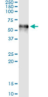 F9 / Factor IX Antibody - Immunoprecipitation of F9 transfected lysate using anti-F9 monoclonal antibody and Protein A Magnetic Bead, and immunoblotted with F9 rabbit polyclonal antibody.