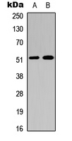 F9 / Factor IX Antibody - Western blot analysis of Factor IX HC expression in A549 (A); NS-1 (B) whole cell lysates.
