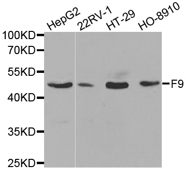 F9 / Factor IX Antibody - Western blot analysis of extracts of various cell lines, using F9 antibody at 1:1000 dilution. The secondary antibody used was an HRP Goat Anti-Rabbit IgG (H+L) at 1:10000 dilution. Lysates were loaded 25ug per lane and 3% nonfat dry milk in TBST was used for blocking.