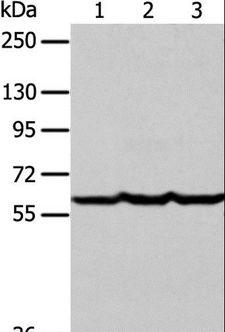 F9 / Factor IX Antibody - Western blot analysis of Human liver cancer tissue, HeLa and Jurkat cell, using F9 Polyclonal Antibody at dilution of 1:400.
