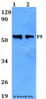 F9 / Factor IX Antibody - Western blot of F9 antibody at 1:500 dilution. Lane 1: A549 whole cell lysate. Lane 2: sp2/0 whole cell lysate.