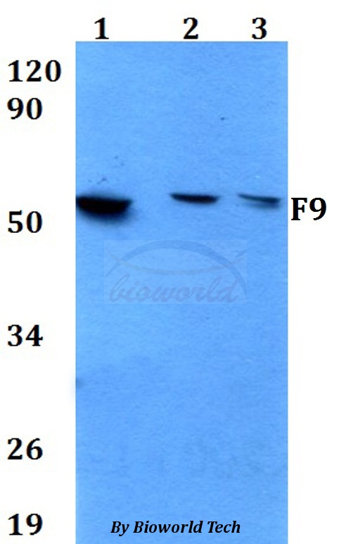 F9 / Factor IX Antibody - Western blot of F9 antibody at 1:500 dilution. Lane 1: A549 whole cell lysate. Lane 2: Raw264.7 whole cell lysate. Lane 3: H9C2 whole cell lysate.