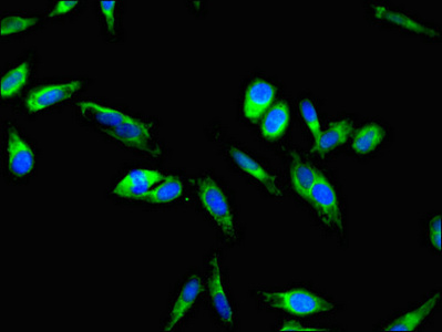 F9 / Factor IX Antibody - Immunofluorescent analysis of Hela cells using F9 Antibody at dilution of 1:100 and Alexa Fluor 488-congugated AffiniPure Goat Anti-Rabbit IgG(H+L)
