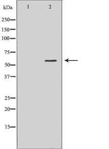 F9 / Factor IX Antibody - Western blot analysis of extracts of HO-8910 using F9 antibody. The lane on the left is treated with the antigen-specific peptide.