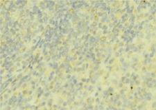 F9 / Factor IX Antibody - 1:100 staining mouse liver tissue by IHC-P. The sample was formaldehyde fixed and a heat mediated antigen retrieval step in citrate buffer was performed. The sample was then blocked and incubated with the antibody for 1.5 hours at 22°C. An HRP conjugated goat anti-rabbit antibody was used as the secondary.
