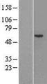 F9 / Factor IX Protein - Western validation with an anti-DDK antibody * L: Control HEK293 lysate R: Over-expression lysate