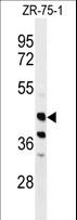 FA2H / FAAH Antibody - Western blot of FA2H Antibody in ZR-75-1 cell line lysates (35 ug/lane). FA2H (arrow) was detected using the purified antibody.