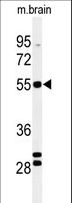 FA2H / FAAH Antibody - Western blot of FA2H Antibody in mouse brain tissue lysates (35 ug/lane). FA2H (arrow) was detected using the purified antibody.