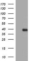 FA2H / FAAH Antibody - HEK293T cells were transfected with the pCMV6-ENTRY control (Left lane) or pCMV6-ENTRY FA2H (Right lane) cDNA for 48 hrs and lysed. Equivalent amounts of cell lysates (5 ug per lane) were separated by SDS-PAGE and immunoblotted with anti-FA2H.
