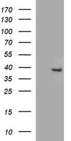 FA2H / FAAH Antibody - HEK293T cells were transfected with the pCMV6-ENTRY control (Left lane) or pCMV6-ENTRY FA2H (Right lane) cDNA for 48 hrs and lysed. Equivalent amounts of cell lysates (5 ug per lane) were separated by SDS-PAGE and immunoblotted with anti-FA2H.