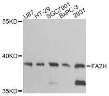 FA2H / FAAH Antibody - Western blot analysis of extracts of various cell lines, using FA2H antibody at 1:3000 dilution. The secondary antibody used was an HRP Goat Anti-Rabbit IgG (H+L) at 1:10000 dilution. Lysates were loaded 25ug per lane and 3% nonfat dry milk in TBST was used for blocking. An ECL Kit was used for detection and the exposure time was 90s.