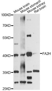 FA2H / FAAH Antibody - Western blot analysis of extracts of various cell lines, using FA2H antibody at 1:3000 dilution. The secondary antibody used was an HRP Goat Anti-Rabbit IgG (H+L) at 1:10000 dilution. Lysates were loaded 25ug per lane and 3% nonfat dry milk in TBST was used for blocking. An ECL Kit was used for detection and the exposure time was 30s.