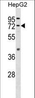 FAAH Antibody - FAAH Antibody western blot of HepG2 cell line lysates (35 ug/lane). The FAAH antibody detected the FAAH protein (arrow).