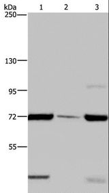 FAAH Antibody - Western blot analysis of LoVo cell, human testis tissue and A549 cell, using FAAH Polyclonal Antibody at dilution of 1:400.