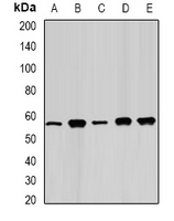 FAAH Antibody - Western blot analysis of FAAH expression in Jurkat (A); HeLa (B); mouse kidney (C); PC12 (D); COS7 (E) whole cell lysates.