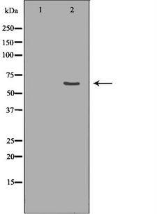 FAAH Antibody - Western blot analysis of mouse brain lysate using FAAH antibody. The lane on the left is treated with the antigen-specific peptide.