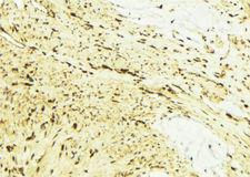 FAAH Antibody - 1:100 staining mouse muscle tissue by IHC-P. The sample was formaldehyde fixed and a heat mediated antigen retrieval step in citrate buffer was performed. The sample was then blocked and incubated with the antibody for 1.5 hours at 22°C. An HRP conjugated goat anti-rabbit antibody was used as the secondary.