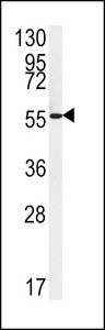 FAAH2 Antibody - Western blot of FAAH2 Antibody in HepG2 cell line lysates (35 ug/lane). FAAH2 (arrow) was detected using the purified antibody.