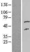 FAAH2 Protein - Western validation with an anti-DDK antibody * L: Control HEK293 lysate R: Over-expression lysate