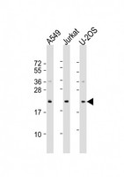 FAAP24 Antibody - All lanes: Anti-FAAP24 Antibody (N-Term) at 1:1000-1:2000 dilution. Lane 1: A549 whole cell lysate. Lane 2: Jurkat whole cell lysate. Lane 3: U-2OS whole cell lysate Lysates/proteins at 20 ug per lane. Secondary Goat Anti-Rabbit IgG, (H+L), Peroxidase conjugated at 1:10000 dilution. Predicted band size: 24 kDa. Blocking/Dilution buffer: 5% NFDM/TBST.