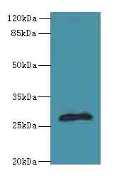 fabI Antibody - Western blot. All lanes: fabI antibody at 5 ug/ml+Mos- heart tissue Goat polyclonal to rabbit at 1:10000 dilution. Predicted band size: 28 kDa. Observed band size: 28 kDa.