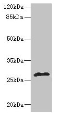 fabI Antibody - Western blot All lanes: fabI antibody at 5µg/ml + Mouse heart tissue Secondary Goat polyclonal to rabbit IgG at 1/10000 dilution Predicted band size: 28 kDa Observed band size: 28 kDa