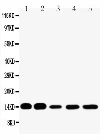 FABP1 / L-FABP Antibody - WB of FABP1 / L-FABP antibody. All lanes: Anti-FABP1 at 0.5ug/ml. Lane 1: Rat Liver Tissue Lysate at 40ug. Lane 2: Rat Kidney Tissue Lysate at 40ug. Lane 3: HELA Whole Cell Lysate at 40ug. Lane 4: NEURO Whole Cell Lysate at 40ug. Lane 5: SMMC Whole Cell Lysate at 40ug. Predicted bind size: 14KD. Observed bind size: 14KD.