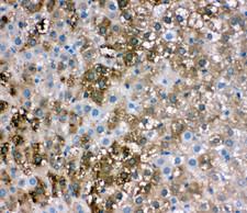 FABP1 / L-FABP Antibody - FABP1 / L-FABP antibody. IHC(P): Rat Liver Tissue.