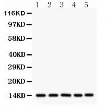 FABP1 / L-FABP Antibody - liver FABP antibody Western blot. All lanes: Anti liver FABP at 0.5 ug/ml. Lane 1: Rat Liver Tissue Lysate at 50 ug. Lane 2: Mouse Liver Tissue Lysate at 50 ug. Lane 3: SMMC Whole Cell Lysate at 40 ug. Lane 4: HEPG2 Whole Cell Lysate at 40 ug. Lane 5: RH35 Whole Cell Lysate at 40 ug. Predicted band size: 14 kD. Observed band size: 14 kD.