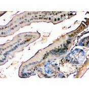 FABP1 / L-FABP Antibody - liver FABP antibody IHC-paraffin. IHC(P): Mouse Intestine Tissue.
