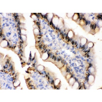 FABP1 / L-FABP Antibody - liver FABP antibody IHC-paraffin. IHC(P): Rat Intestine Tissue.