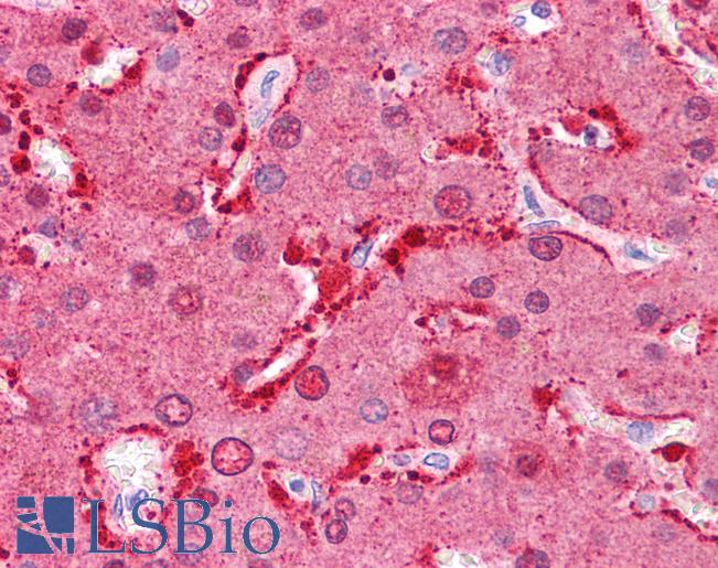 FABP1 / L-FABP Antibody - Anti-FABP1 antibody IHC of human liver. Immunohistochemistry of formalin-fixed, paraffin-embedded tissue after heat-induced antigen retrieval. Antibody concentration 5 ug/ml.  This image was taken for the unconjugated form of this product. Other forms have not been tested.