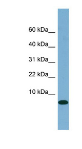 FABP1 / L-FABP Antibody - FABP1 antibody Western blot of Fetal Small Intestine lysate. This image was taken for the unconjugated form of this product. Other forms have not been tested.