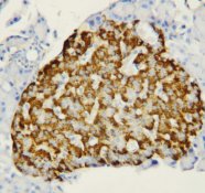 FABP1 / L-FABP Antibody