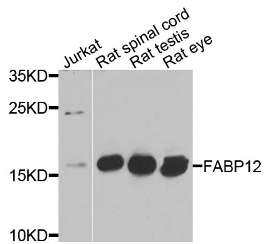 FABP12 Antibody - Western blot analysis of extracts of various cells.