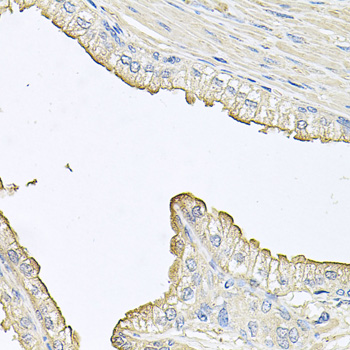 FABP12 Antibody - Immunohistochemistry of paraffin-embedded human prostate.