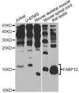 FABP12 Antibody - Western blot analysis of extracts of various cell lines, using FABP12 antibody at 1:1000 dilution. The secondary antibody used was an HRP Goat Anti-Rabbit IgG (H+L) at 1:10000 dilution. Lysates were loaded 25ug per lane and 3% nonfat dry milk in TBST was used for blocking. An ECL Kit was used for detection and the exposure time was 60s.